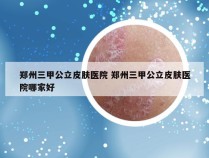 郑州三甲公立皮肤医院 郑州三甲公立皮肤医院哪家好