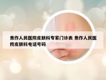 焦作人民医院皮肤科专家门诊表 焦作人民医院皮肤科电话号码