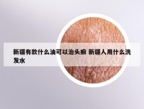 新疆有款什么油可以治头癣 新疆人用什么洗发水