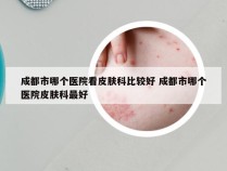 成都市哪个医院看皮肤科比较好 成都市哪个医院皮肤科最好