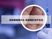 皮肤癣病是什么 皮肤癣的治疗方法