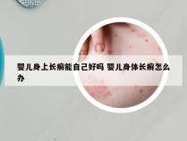 婴儿身上长癣能自己好吗 婴儿身体长癣怎么办