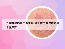 二院皮肤科哪个医生好 河北省二院皮肤科哪个医生好