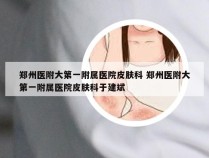 郑州医附大第一附属医院皮肤科 郑州医附大第一附属医院皮肤科于建斌