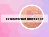 银屑病被诊断为寻麻疹 银屑病并发荨麻疹