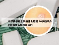 10岁孩子身上长癣什么原因 10岁孩子身上长癣什么原因造成的