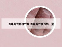 百年癣方价格效果 百年癣方多少钱一盒