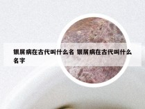 银屑病在古代叫什么名 银屑病在古代叫什么名字