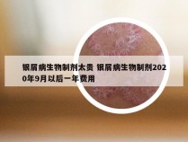 银屑病生物制剂太贵 银屑病生物制剂2020年9月以后一年费用