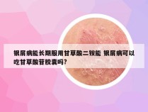 银屑病能长期服用甘草酸二铵能 银屑病可以吃甘草酸苷胶囊吗?