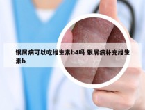 银屑病可以吃维生素b4吗 银屑病补充维生素b