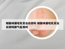 硝酸咪康唑乳膏治白斑吗 硝酸咪康唑乳膏治白斑吗脚气能用吗