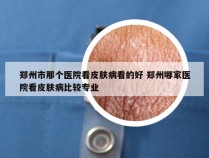 郑州市那个医院看皮肤病看的好 郑州哪家医院看皮肤病比较专业