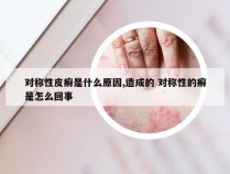 对称性皮癣是什么原因,造成的 对称性的癣是怎么回事