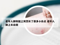 老年人脚和腿上突然长了很多小白点 老年人脚上长白斑