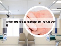 生物制剂要打多久 生物制剂要打多久能见效果