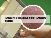 哈尔滨治银屑病真诚青年医学会 哈尔滨哪家看银屑病