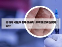 廊坊哪间医院看牛皮癣好 廊坊皮肤病医院哪家好