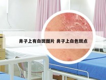 鼻子上有白斑图片 鼻子上白色斑点