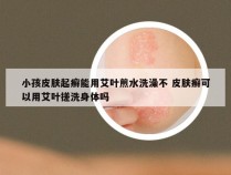 小孩皮肤起癣能用艾叶煎水洗澡不 皮肤癣可以用艾叶搓洗身体吗