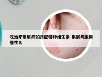 吃治疗银屑病的药配哪种维生素 银屑病服用维生素