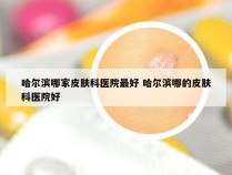 哈尔滨哪家皮肤科医院最好 哈尔滨哪的皮肤科医院好