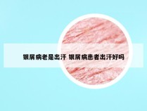 银屑病老是出汗 银屑病患者出汗好吗