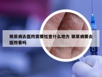 银屑病去医院需要检查什么地方 银屑病要去医院看吗