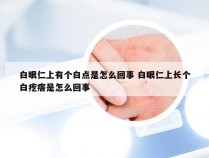 白眼仁上有个白点是怎么回事 白眼仁上长个白疙瘩是怎么回事