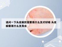 请问一下头皮癣厉害要用什么洗才好哦 头皮癣要用什么洗发水