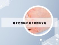 身上忽然长藓 身上突然长了藓