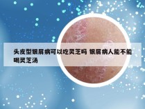 头皮型银屑病可以吃灵芝吗 银屑病人能不能喝灵芝汤