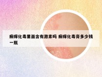 癣痒化毒里面含有激素吗 癣痒化毒膏多少钱一瓶