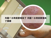 大腿一小块皮肤变白了 大腿一小块皮肤变白了很痒