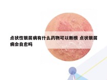 点状性银屑病有什么药物可以断根 点状银屑病会自愈吗