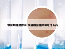 银屑病健脾除湿 银屑病健脾除湿吃什么药