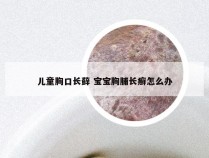 儿童胸口长藓 宝宝胸脯长癣怎么办