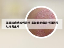 掌趾脓疱病如何治疗 掌趾脓疱病治疗期间可以吃黄鱼吗