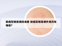 脓疱型银屑病找谁看 脓疱型银屑病外用药有哪些?