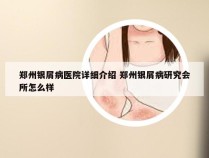 郑州银屑病医院详细介绍 郑州银屑病研究会所怎么样