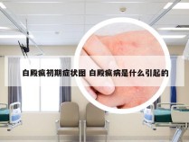 白殿疯初期症状图 白殿疯病是什么引起的