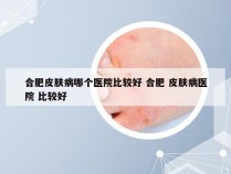 合肥皮肤病哪个医院比较好 合肥 皮肤病医院 比较好