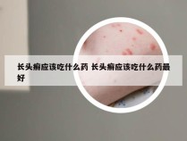 长头癣应该吃什么药 长头癣应该吃什么药最好