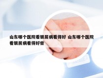 山东哪个医院看银屑病看得好 山东哪个医院看银屑病看得好些