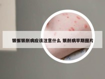 银懈银削病应该注意什么 银削病早期图片