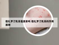 他扎罗汀乳膏是激素吗 他扎罗汀乳膏的作用原理