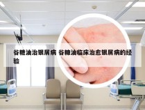 谷糖油治银屑病 谷糠油临床治愈银屑病的经验