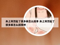 身上突然起了很多癣怎么回事 身上突然起了很多癣怎么回事啊