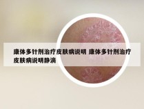 康体多针剂治疗皮肤病说明 康体多针剂治疗皮肤病说明静滴