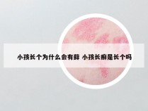 小孩长个为什么会有藓 小孩长癣是长个吗